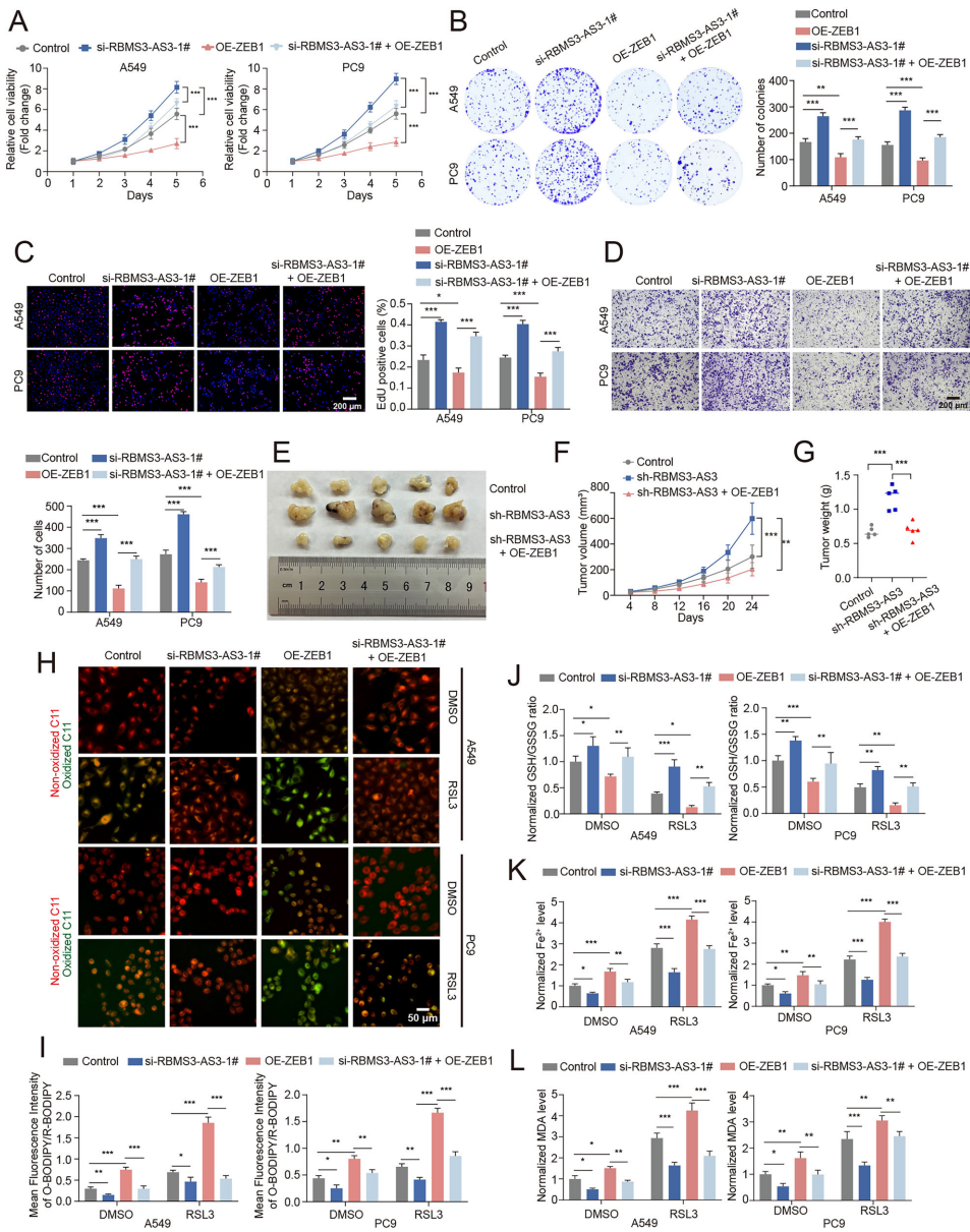 m6A-ALKBH5依赖的RBMS3-AS3下调通过HNRNPDL/ZEB1/GPX4轴抑制铁死亡促进肺腺癌进展 - 生物通